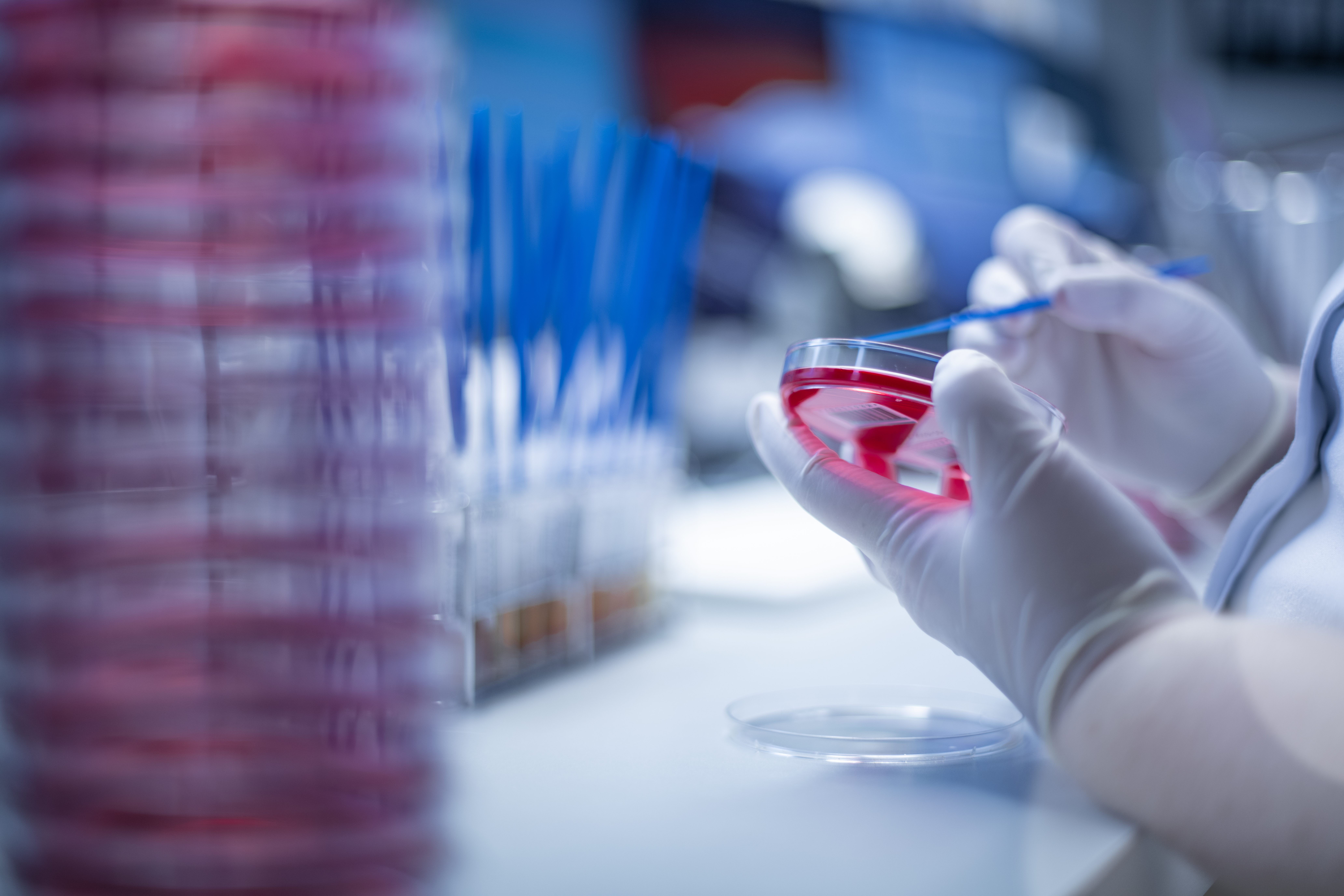 Mikrobiologische Nachweismöglichkeiten von Erregern